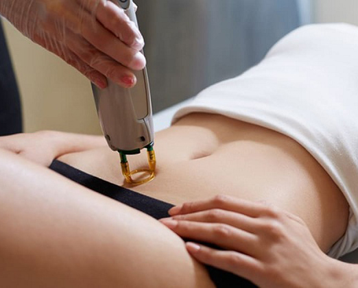 Triệt Lông Bikini Tại Sen Beauty